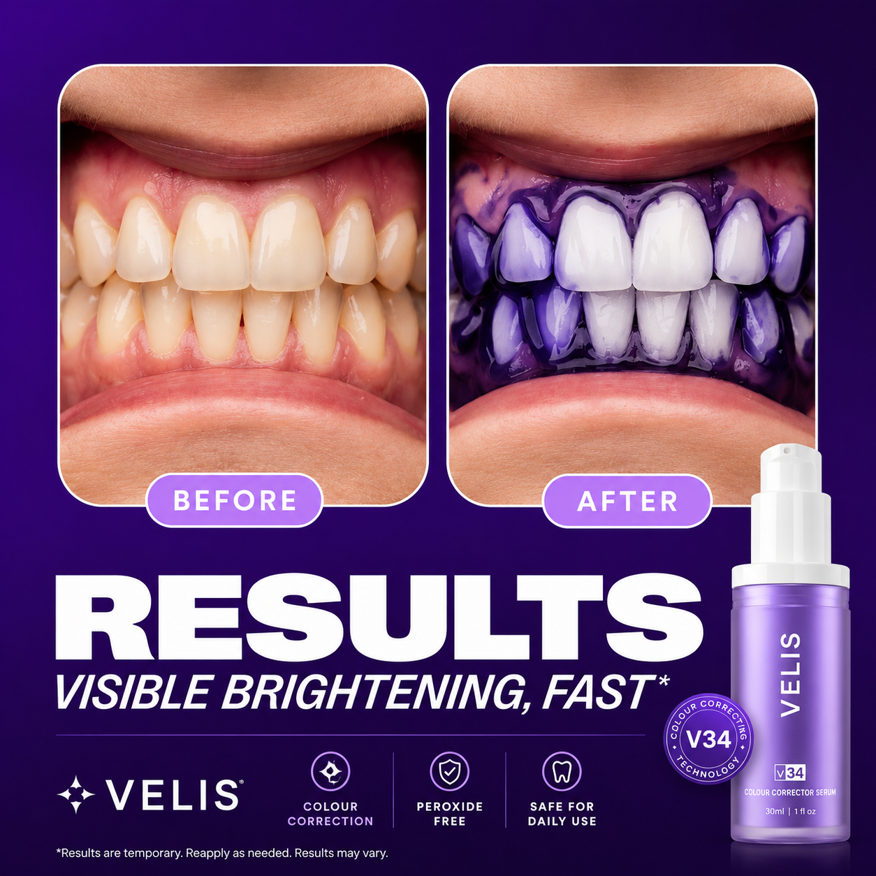 VELIS V34 Teeth Whitening Color Corrector