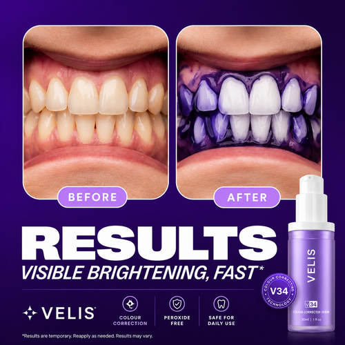 VELIS V34 Teeth Whitening Color Corrector